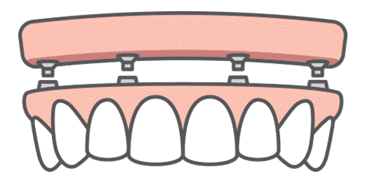 full arch icon
